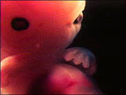 An Embryo